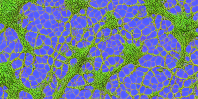 Mathematical Modeling of Lymphangiogenesis: A Convex-Splitting Scheme Approach