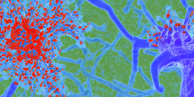 Anatomic-Conditional Image Algorithm Enhances Prostate Cancer Detection in Diffusion MRI