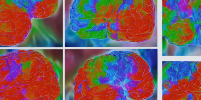 Brain Tumor Segmentation Using Deep Learning Techniques in MRI Images: A Comprehensive Review